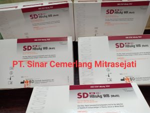Rapid Test HBsAg SD Bioline