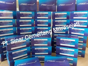 RAPID TEST HCV CARD FOKUS DIAGNOSTIC